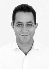 ZÉ BRAQUIARA