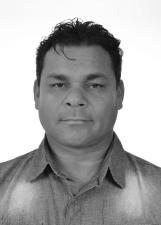 AGNALDO PROTETICO