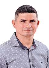 DOUGLAS LIMA
