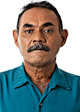 ADALBERTO LOPES
