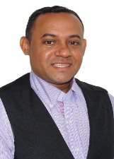 TONY SILVA