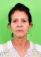 ANA ALKIMIM