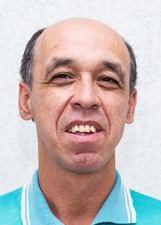 AGNALDO ALMEIDA