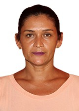LETE NUNES