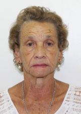 ALICE DIAS