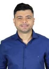 CARLOS ALBERTO