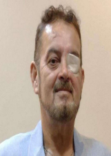 EDER VITERBO