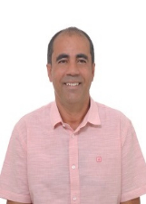 BIU DA CAFÍSTULA