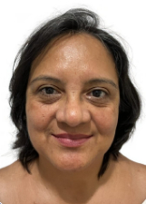NELCY DE CASTRO