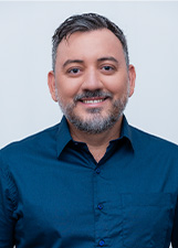 AMILSON DILACERDA