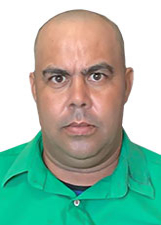 DENILSON FRENTISTA