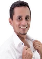 ANDERSON FERNANDES