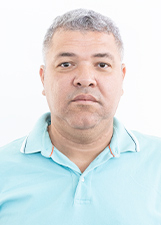 TECO DE BEIJO