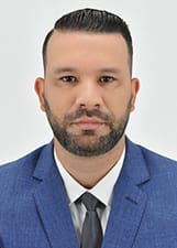 DOUGLAS TEIXEIRA