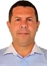 ALEX ENFERMEIRO