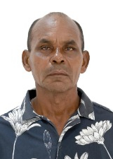 RADI