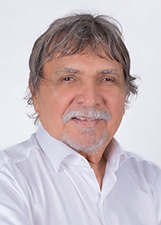 NOE PALHETA