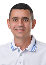 ALBERTO DE BRAS