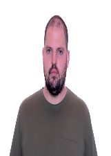 KURT