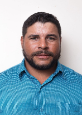 DOUGLAS LIMA